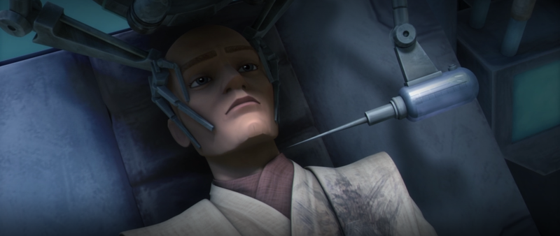 Plik:Obi zmienia twarz.png
